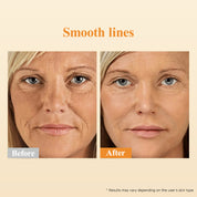 HKH Retinol + HPR Serum fürs Gesicht – Anti-Aging-Nachtpflege gegen Falten – Retinol-Kapseln – Peptidserum für Frauen – Strafft die Haut gegen feine Linien und schlaffe Haut – Frei von Duftstoffen und Alkohol, nicht fettend