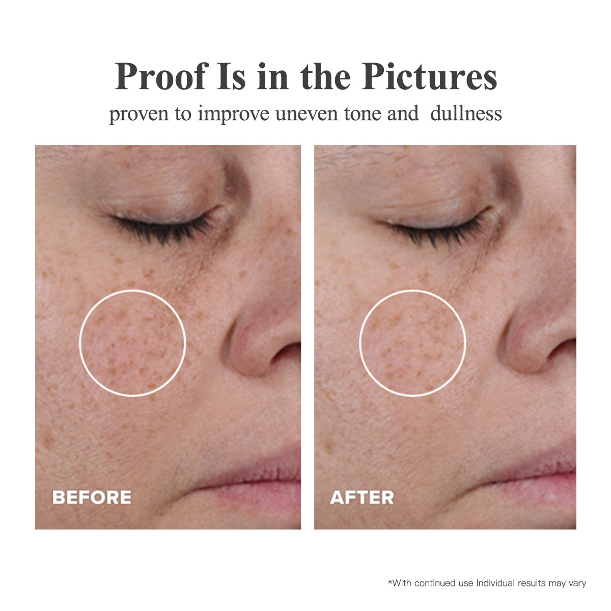 Dreifach-Vitamin-C-Serum-Kapseln für das Gesicht: Korrektur von Pigmentflecken mit Kamelien-Niacinamid VE Anti-Aging-Serum für Frauen - 28 Kapseln zur Straffung schlaffer Haut und feiner Linien